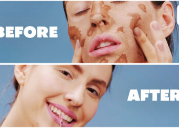 VideoHive Clean Before and After 59465692